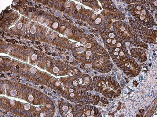 Coronin 1A Antibody in Immunohistochemistry (Paraffin) (IHC (P))