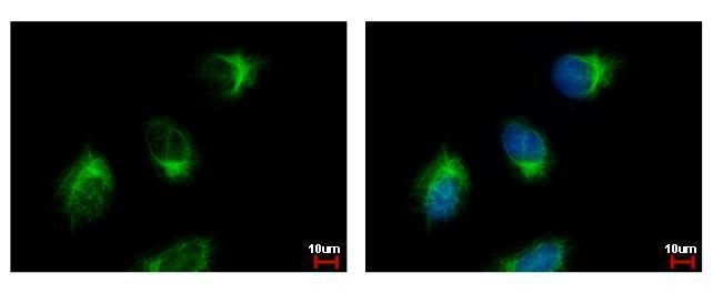 GGA3 Antibody in Immunocytochemistry (ICC/IF)