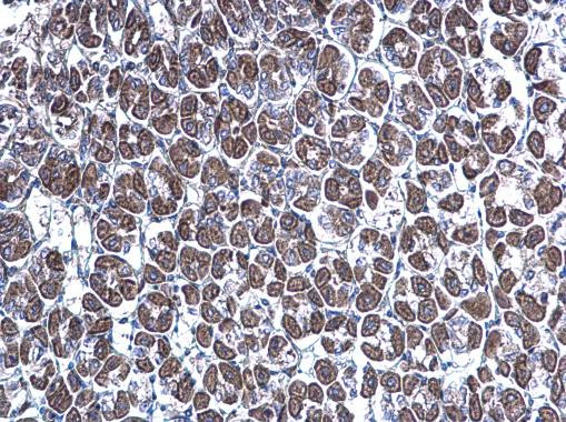 GGA3 Antibody in Immunohistochemistry (Paraffin) (IHC (P))