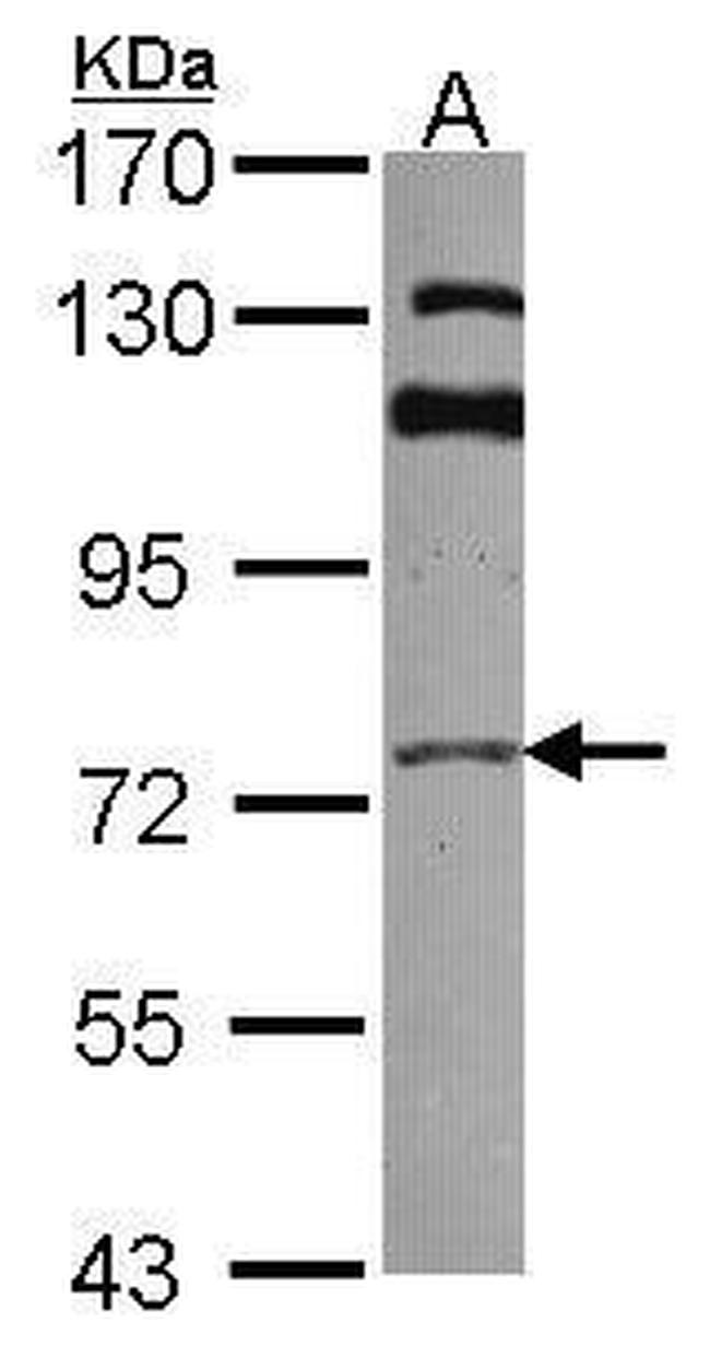 GGA3 Antibody in Western Blot (WB)