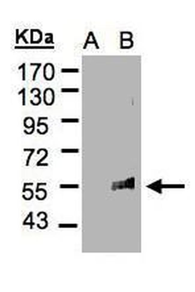 FLVCR1 Antibody in Western Blot (WB)