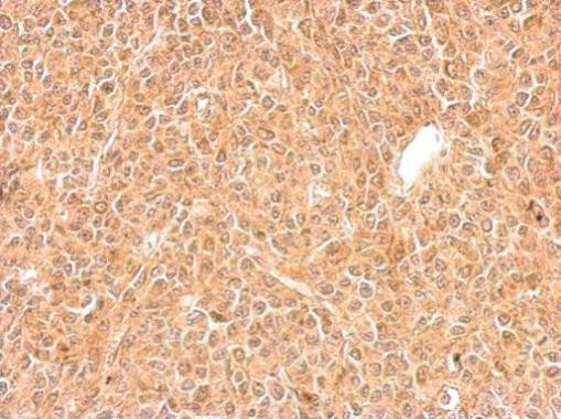 GGPS1 Antibody in Immunohistochemistry (Paraffin) (IHC (P))