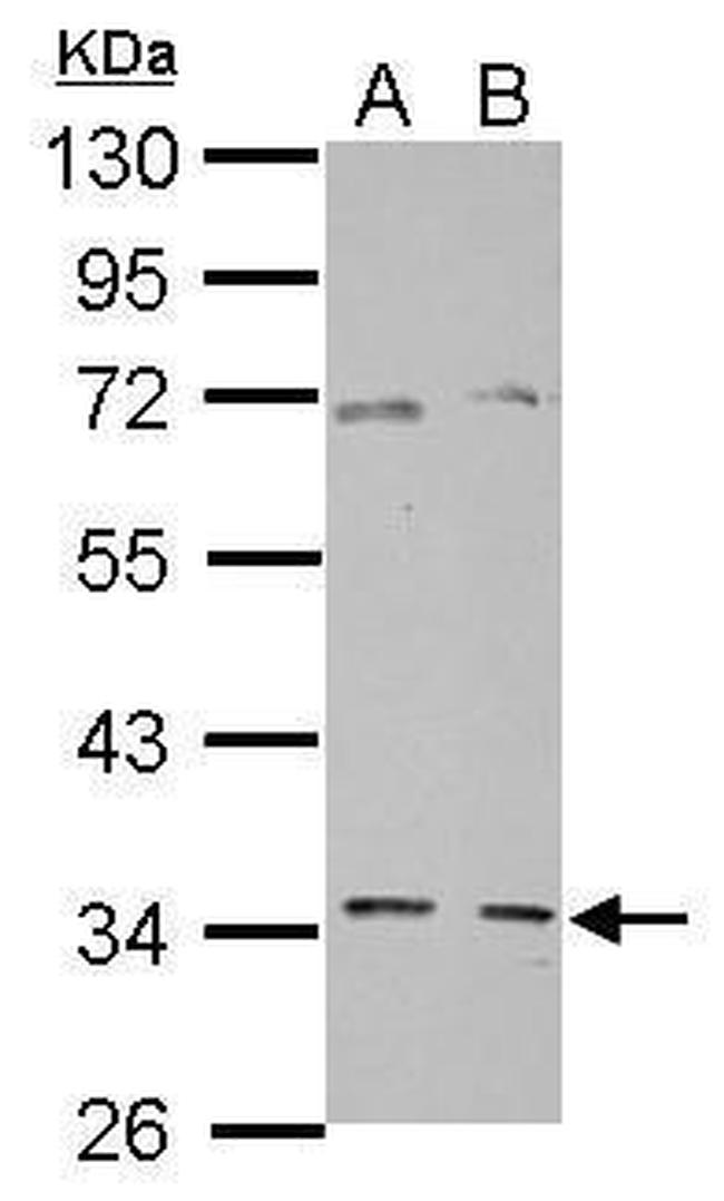 GGPS1 Antibody in Western Blot (WB)