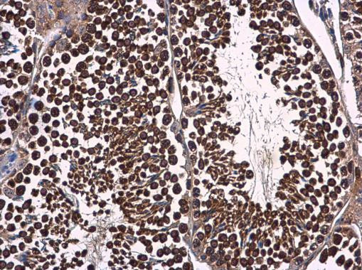 p23 Antibody in Immunohistochemistry (Paraffin) (IHC (P))