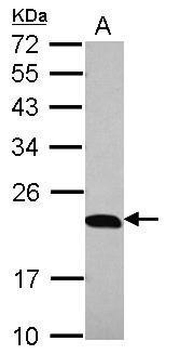 p23 Antibody in Western Blot (WB)