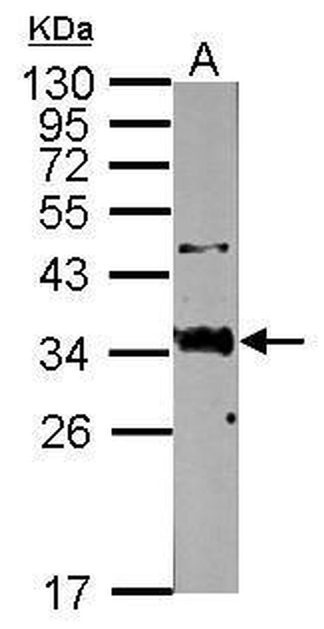 SFTPA1 Antibody in Western Blot (WB)