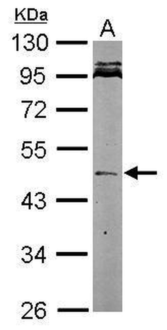 Nodal Antibody in Western Blot (WB)