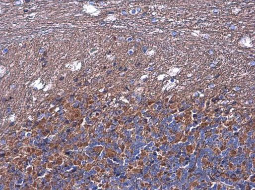 Nodal Antibody in Immunohistochemistry (Paraffin) (IHC (P))