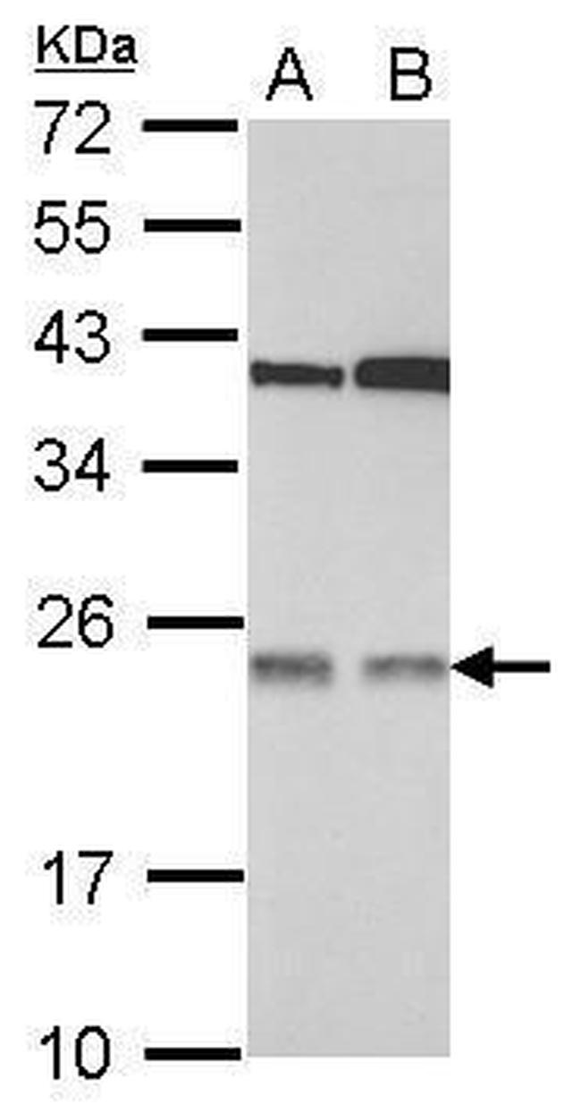 p27 Antibody in Western Blot (WB)