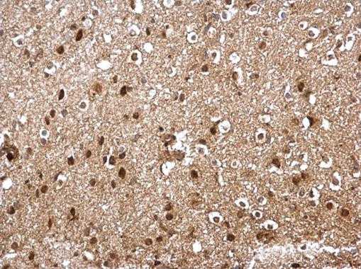 SKP1 Antibody in Immunohistochemistry (Paraffin) (IHC (P))