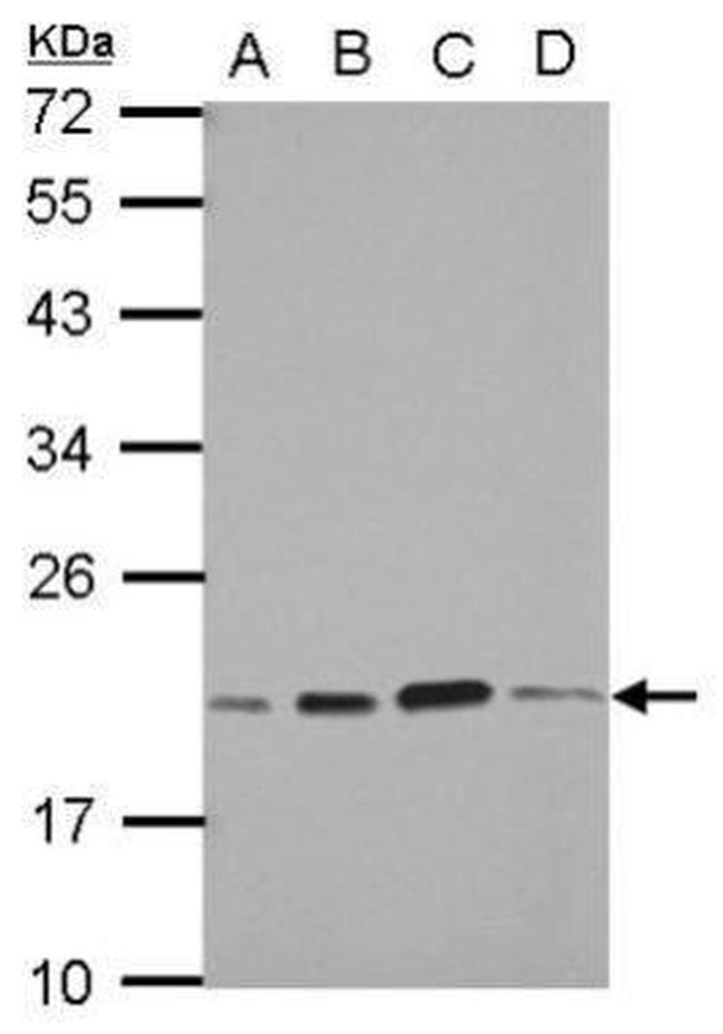 SKP1 Antibody in Western Blot (WB)