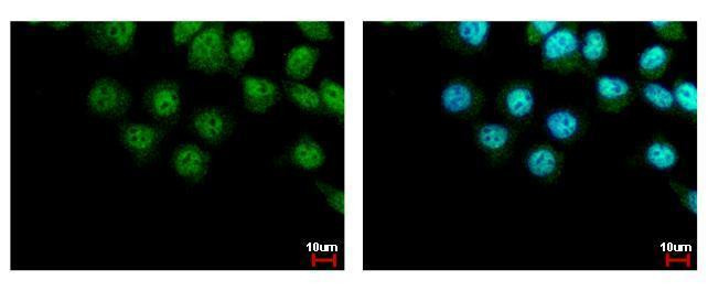 LIMD1 Antibody in Immunocytochemistry (ICC/IF)