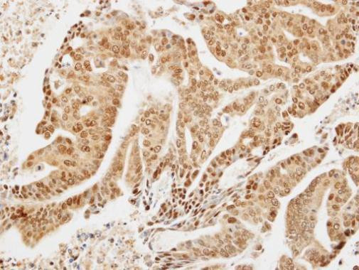 LIMD1 Antibody in Immunohistochemistry (Paraffin) (IHC (P))