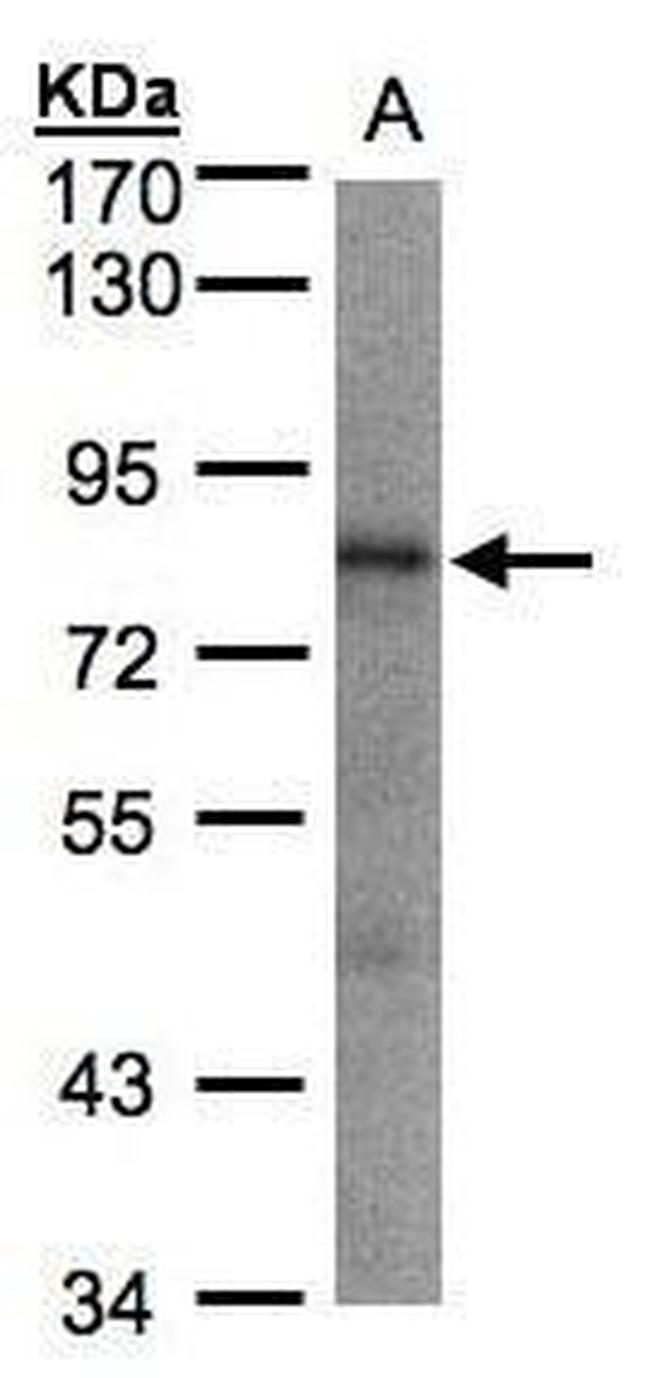 LIMD1 Antibody in Western Blot (WB)
