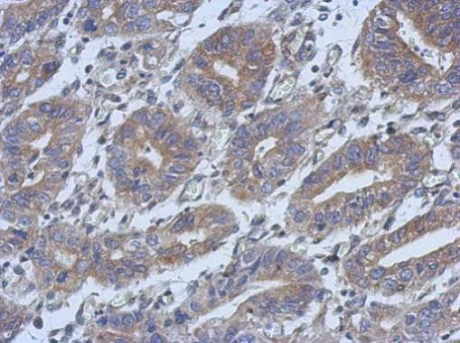 HAUS4 Antibody in Immunohistochemistry (Paraffin) (IHC (P))