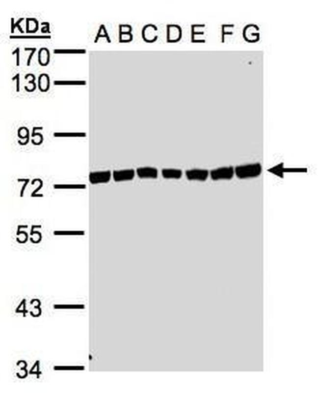 KIAA1530 Antibody in Western Blot (WB)