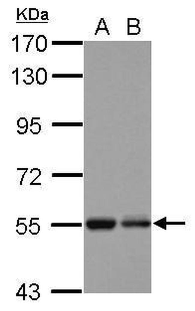 KBTBD4 Antibody in Western Blot (WB)