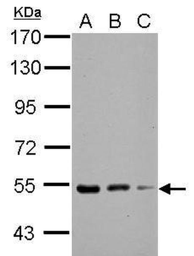 KBTBD4 Antibody in Western Blot (WB)