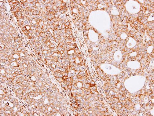 THUMPD3 Antibody in Immunohistochemistry (Paraffin) (IHC (P))