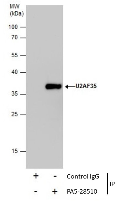 U2AF1 Antibody in Immunoprecipitation (IP)