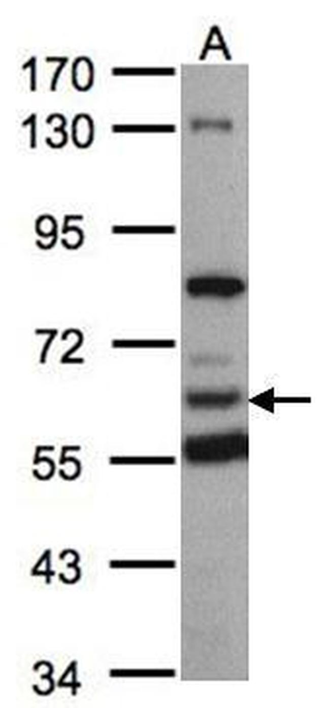 HACL1 Antibody in Western Blot (WB)