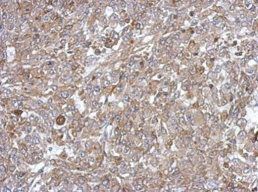 C18orf25 Antibody in Immunohistochemistry (Paraffin) (IHC (P))