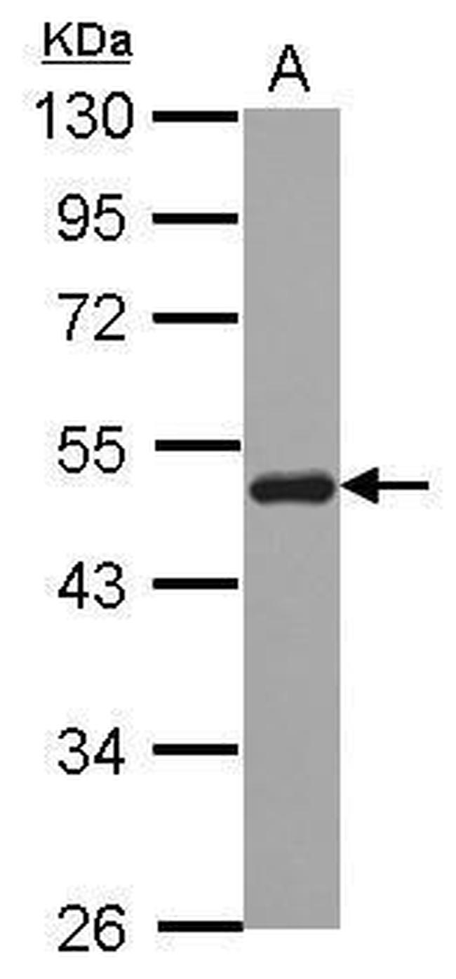 SNX5 Antibody in Western Blot (WB)