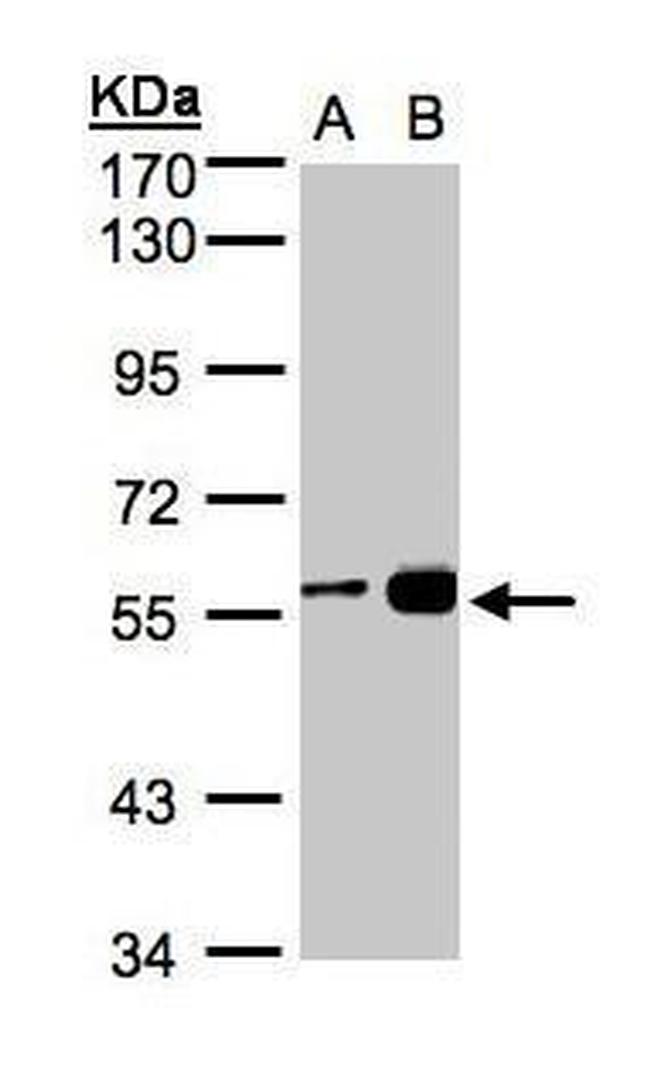 RCC2 Antibody in Western Blot (WB)