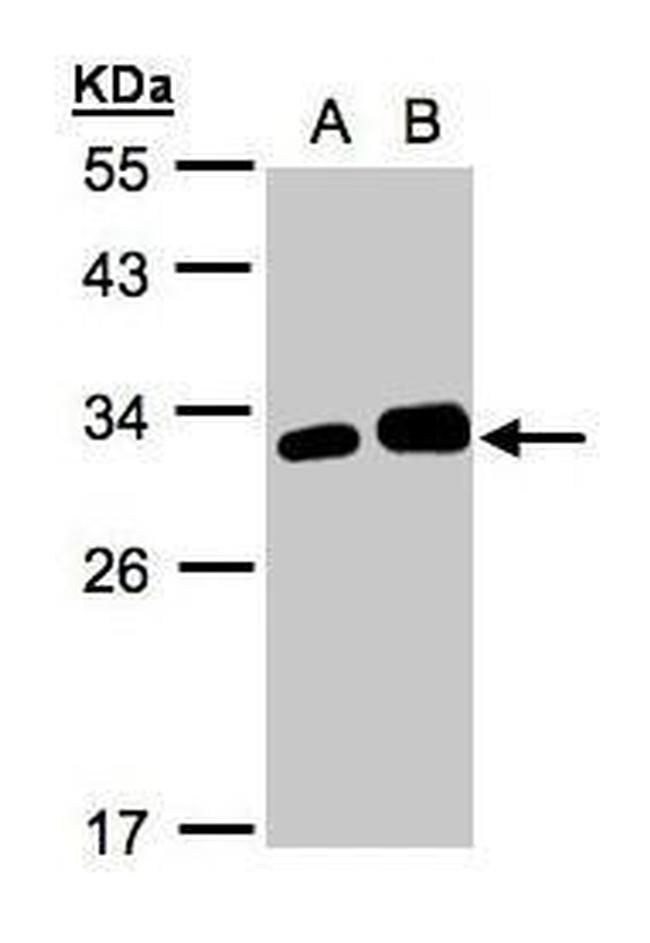 Latexin Antibody in Western Blot (WB)