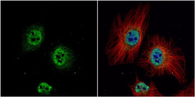 ZWINT Antibody in Immunocytochemistry (ICC/IF)