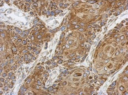 C1orf111 Antibody in Immunohistochemistry (Paraffin) (IHC (P))