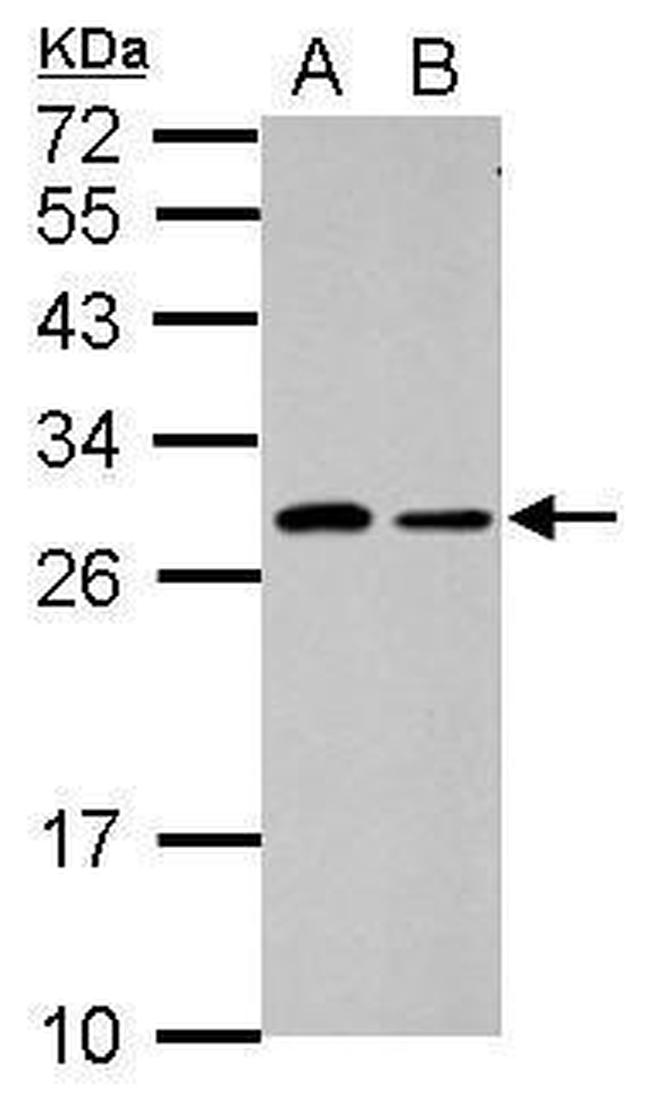 C1orf111 Antibody in Western Blot (WB)