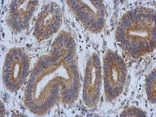 DCBLD2 Antibody in Immunohistochemistry (Paraffin) (IHC (P))