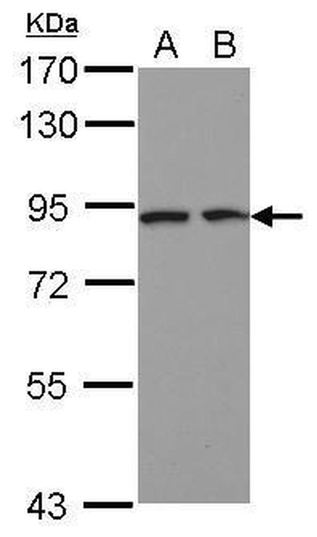 DCBLD2 Antibody in Western Blot (WB)