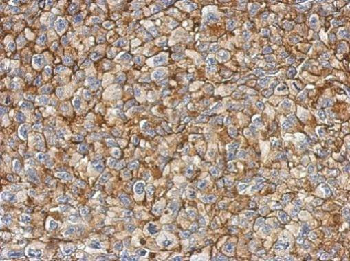 FAM83B Antibody in Immunohistochemistry (Paraffin) (IHC (P))