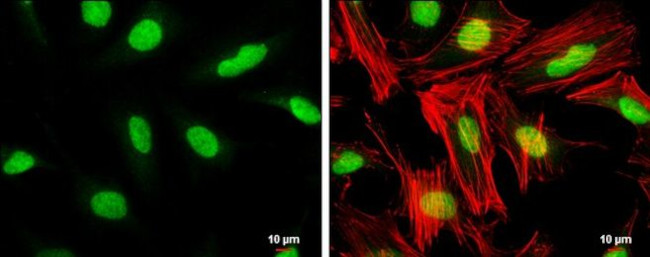 GTF2B Antibody in Immunocytochemistry (ICC/IF)