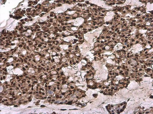 GTF2B Antibody in Immunohistochemistry (Paraffin) (IHC (P))