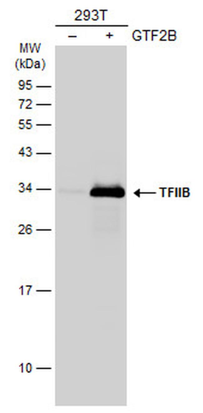 GTF2B Antibody in Western Blot (WB)