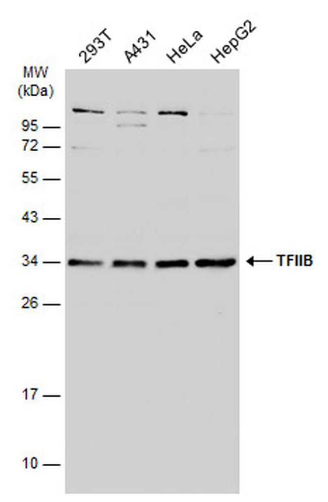 GTF2B Antibody in Western Blot (WB)