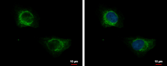 KRT71 Antibody in Immunocytochemistry (ICC/IF)