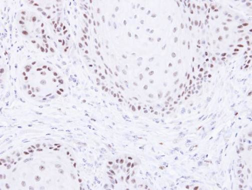 PAF1 Antibody in Immunohistochemistry (Paraffin) (IHC (P))