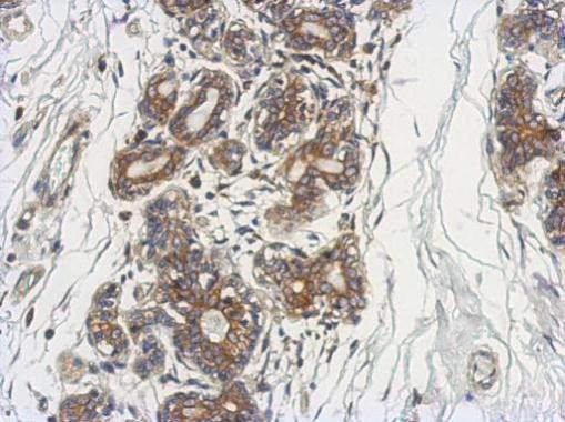 DCUN1D4 Antibody in Immunohistochemistry (Paraffin) (IHC (P))