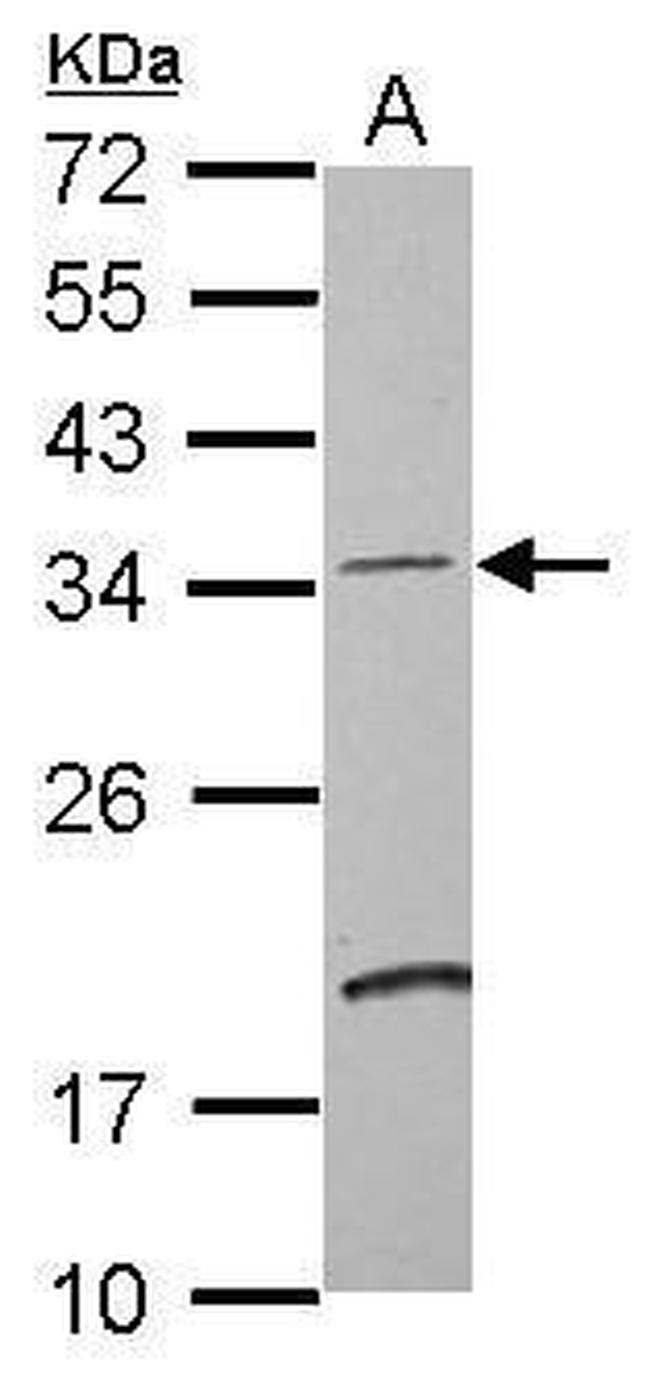 DCUN1D4 Antibody in Western Blot (WB)