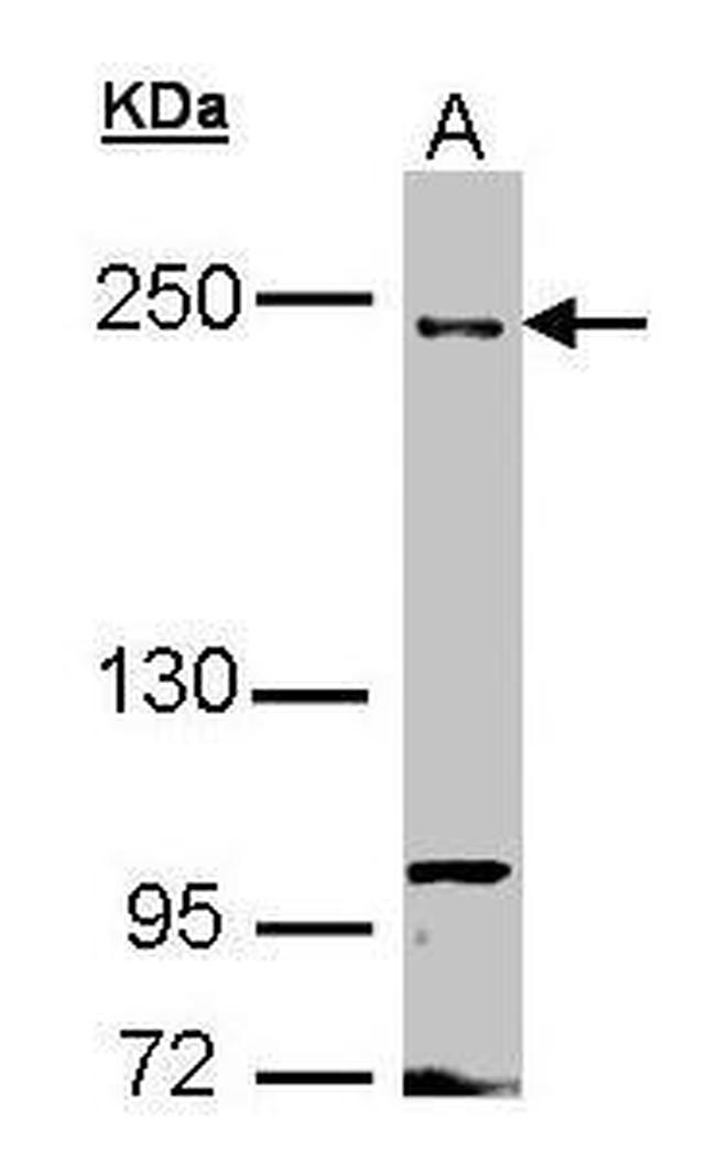 FIP200 Antibody in Western Blot (WB)