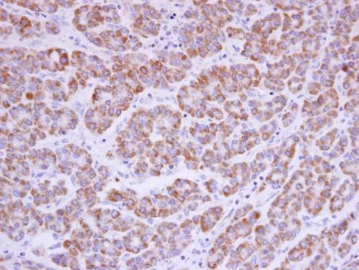 AGK Antibody in Immunohistochemistry (Paraffin) (IHC (P))