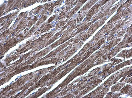 AGK Antibody in Immunohistochemistry (Paraffin) (IHC (P))