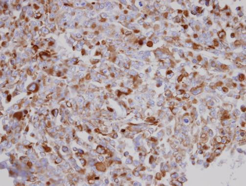 AGK Antibody in Immunohistochemistry (Paraffin) (IHC (P))