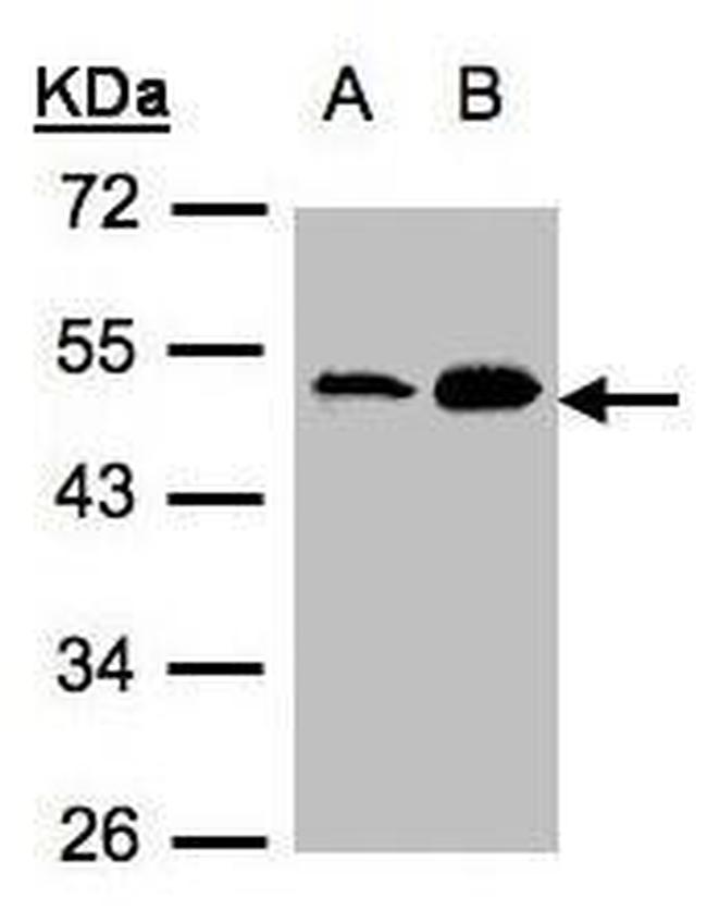 AGK Antibody in Western Blot (WB)