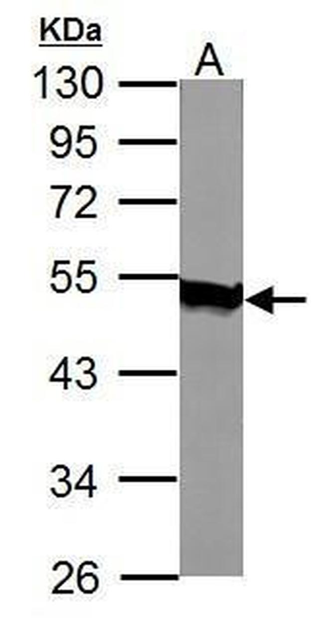 AGK Antibody in Western Blot (WB)