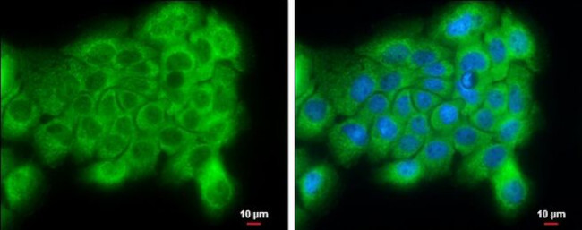 PI4KA Antibody in Immunocytochemistry (ICC/IF)